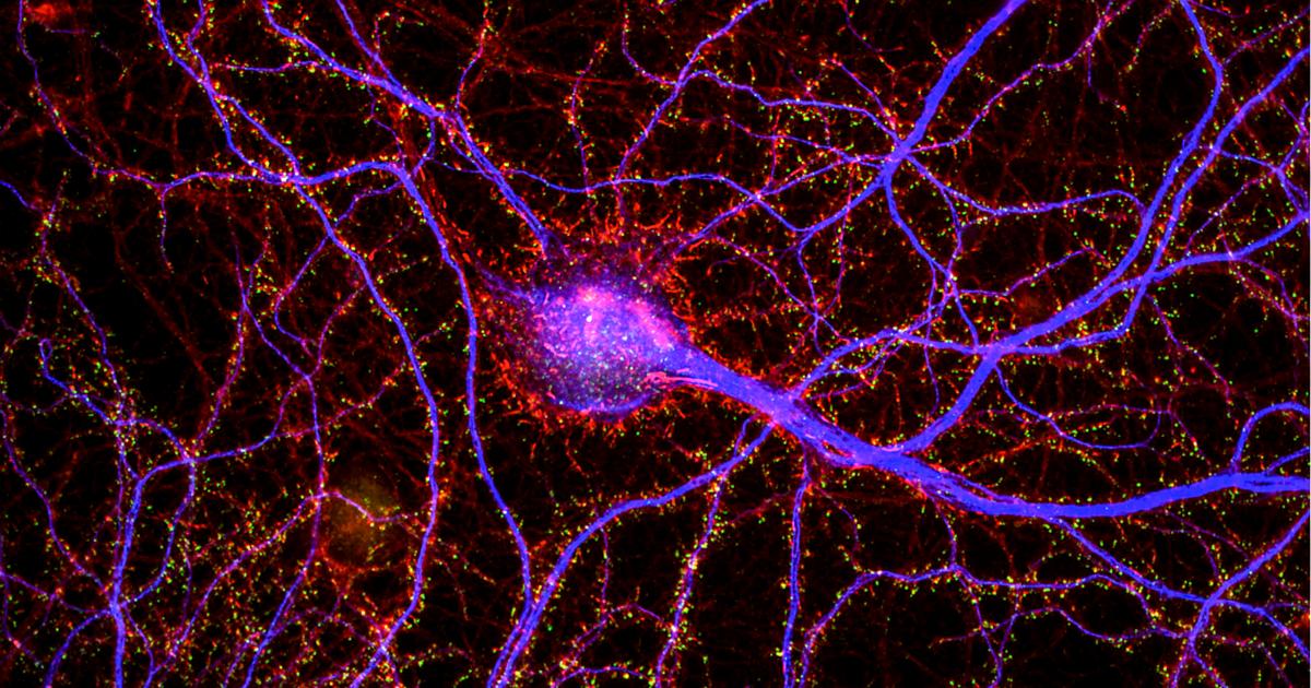 Dendrites: Molecules, Structure, And Function | Picower Institute